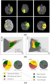 brain tumor segmentation with deep neural networks